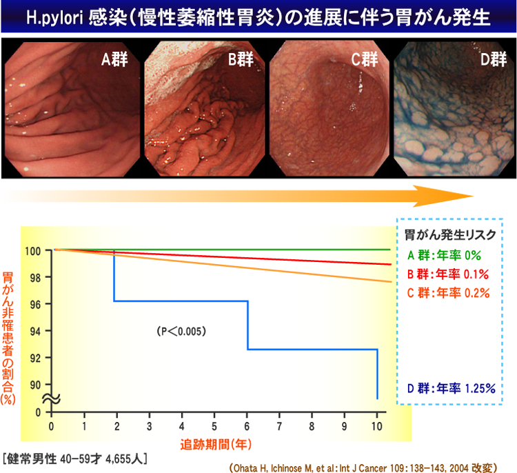 H.pylori+%B4%B6%C0%F7%A1%CA%CB%FD%C0%AD%B0%E0%BD%CC%C0%AD%B0%DF%B1%EA%A1%CB%A4%CE%BF%CA%C5%B8%A4%CB%C8%BC%A4%A6%B0%DF%A4%AC%A4%F3%C8%AF%C0%B8