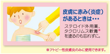 皮膚に赤みがあるときは